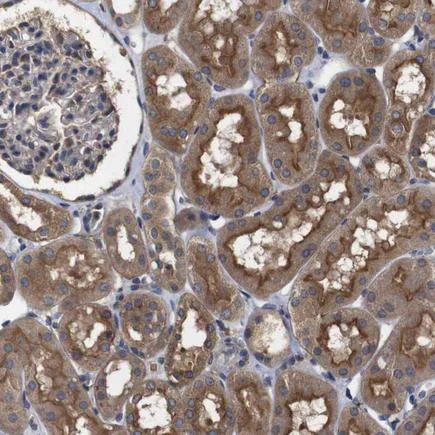 Immunohistochemistry (Formalin/PFA-fixed paraffin-embedded sections) - Anti-FILGAP antibody (AB224371)
