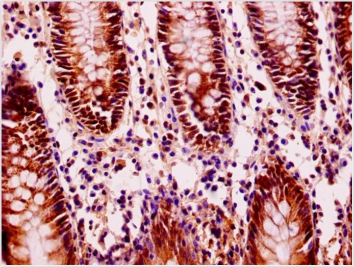 Immunohistochemistry (Formalin/PFA-fixed paraffin-embedded sections) - Anti-FILIP1L antibody (AB236979)