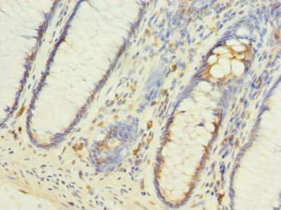 Immunohistochemistry (Formalin/PFA-fixed paraffin-embedded sections) - Anti-FILIP1L antibody (AB236979)