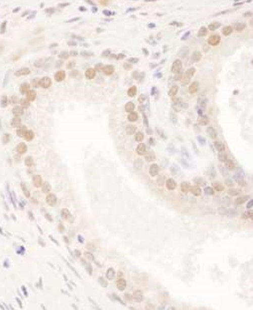 Immunohistochemistry (Formalin/PFA-fixed paraffin-embedded sections) - Anti-FIP antibody (AB125184)