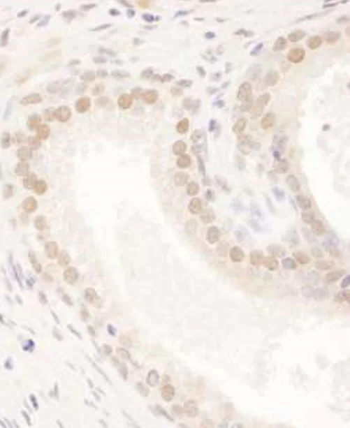 Immunohistochemistry (Formalin/PFA-fixed paraffin-embedded sections) - Anti-FIP antibody (AB125184)