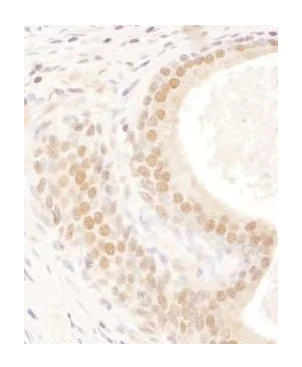 Immunohistochemistry (Formalin/PFA-fixed paraffin-embedded sections) - Anti-FIP antibody (AB264330)
