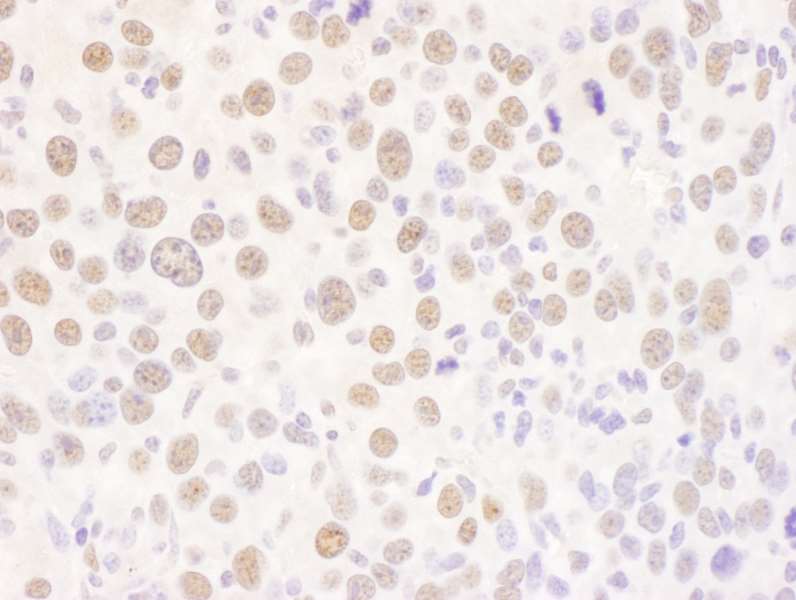 Immunohistochemistry (Formalin/PFA-fixed paraffin-embedded sections) - Anti-FIP antibody (AB264330)