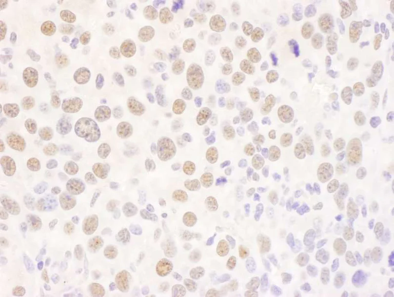 Immunohistochemistry (Formalin/PFA-fixed paraffin-embedded sections) - Anti-FIP antibody (AB264330)