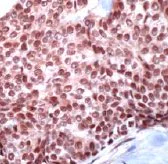 Immunohistochemistry (Formalin/PFA-fixed paraffin-embedded sections) - Anti-FIP antibody (AB32616)
