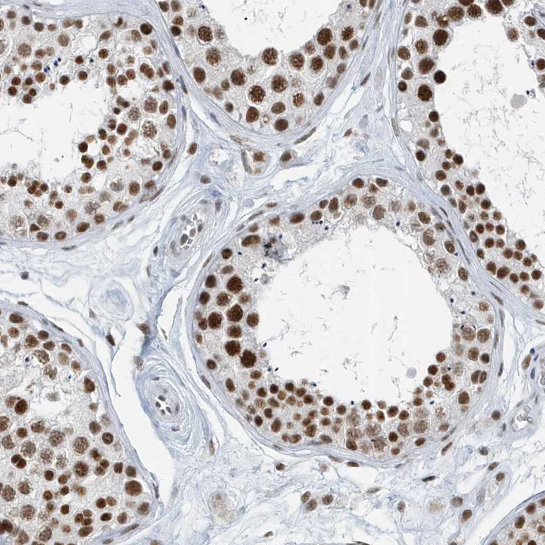 Immunohistochemistry (Formalin/PFA-fixed paraffin-embedded sections) - Anti-FIP1L1 antibody (AB224539)