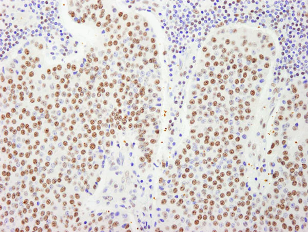 Immunohistochemistry (Formalin/PFA-fixed paraffin-embedded sections) - Anti-FIP1L1 antibody (AB80271)
