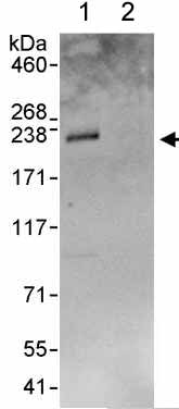 Immunoprecipitation - Anti-FIP200 antibody (AB176816)