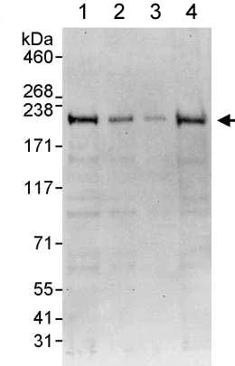 Western blot - Anti-FIP200 antibody (AB176816)