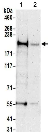 Western blot - Anti-FIP200 antibody (AB176816)