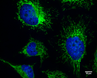 Immunocytochemistry/ Immunofluorescence - Anti-FIP200 antibody (AB227726)
