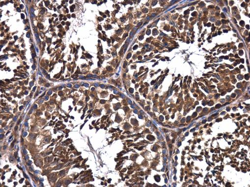 Immunohistochemistry (Formalin/PFA-fixed paraffin-embedded sections) - Anti-FIP200 antibody (AB272871), expandable thumbnail