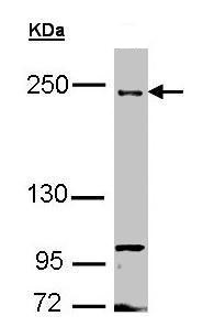 Western blot - Anti-FIP200 antibody (AB272871), expandable thumbnail