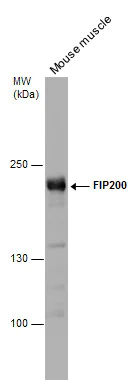 Western blot - Anti-FIP200 antibody (AB272871)