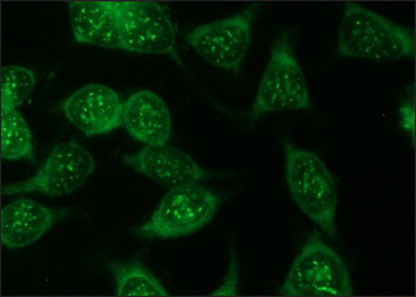 Immunocytochemistry/ Immunofluorescence - Anti-Firefly Luciferase antibody (AB21176), expandable thumbnail