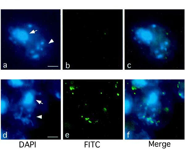 Immunocytochemistry/ Immunofluorescence - FITC Anti-5-methylcytosine (5-mC) antibody [5MC-CD] (AB179898)