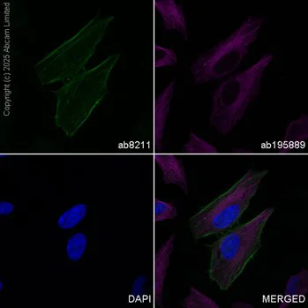 Immunocytochemistry/ Immunofluorescence - FITC Anti-alpha smooth muscle Actin antibody [1A4] (AB8211)