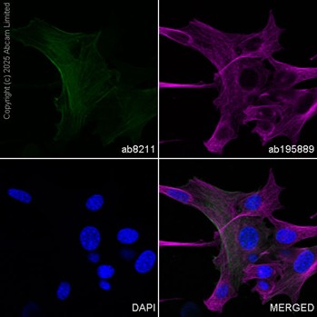 FITC Anti-alpha smooth muscle Actin 抗体 [1A4] (ab8211) | Abcam