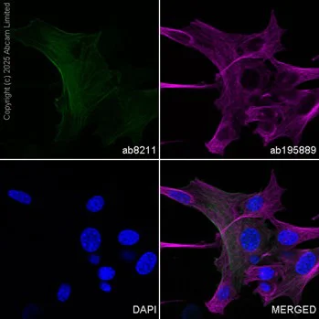 Immunocytochemistry/ Immunofluorescence - FITC Anti-alpha smooth muscle Actin antibody [1A4] (AB8211)
