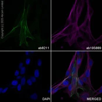 Immunocytochemistry/ Immunofluorescence - FITC Anti-alpha smooth muscle Actin antibody [1A4] (AB8211)