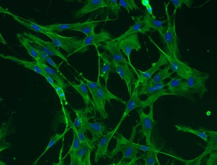Immunocytochemistry/ Immunofluorescence - FITC Anti-beta Actin antibody [AC-15] (AB6277), expandable thumbnail