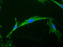 Immunocytochemistry/ Immunofluorescence - FITC Anti-beta Actin antibody [AC-15] (AB6277), expandable thumbnail