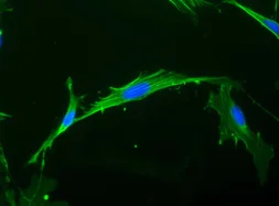 Immunocytochemistry/ Immunofluorescence - FITC Anti-beta Actin antibody [AC-15] - Cytoskeleton Marker (AB6277)