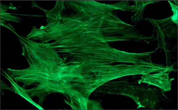 Immunocytochemistry/ Immunofluorescence - FITC Anti-beta Actin antibody [AC-15] (AB6277), expandable thumbnail