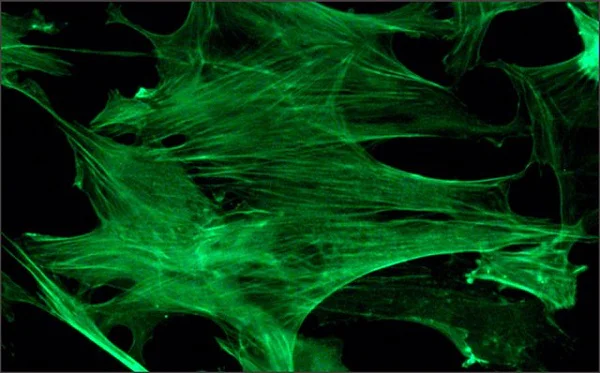 Immunocytochemistry/ Immunofluorescence - FITC Anti-beta Actin antibody [AC-15] - Cytoskeleton Marker (AB6277)