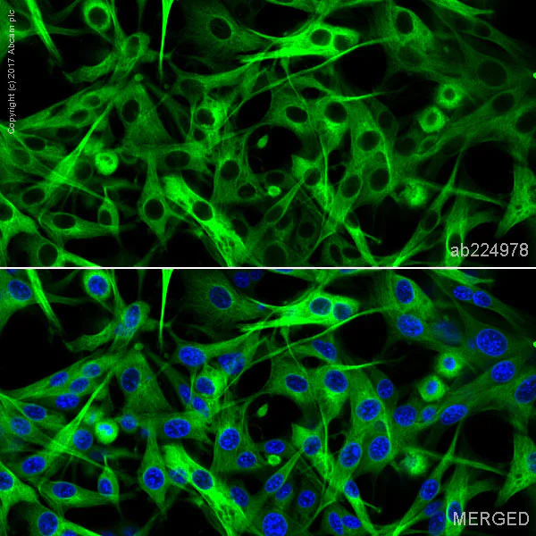 Immunocytochemistry/ Immunofluorescence - FITC Anti-beta III Tubulin antibody [EP1569Y] - Neuronal Marker (AB224978)
