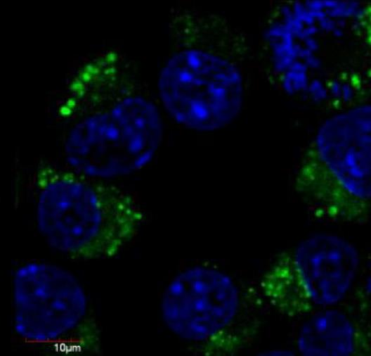 Immunocytochemistry - FITC Anti-beta III Tubulin antibody [TU-20] (AB25770), expandable thumbnail