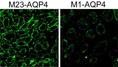 Immunocytochemistry - FITC Anti-C1q antibody (AB4223), expandable thumbnail