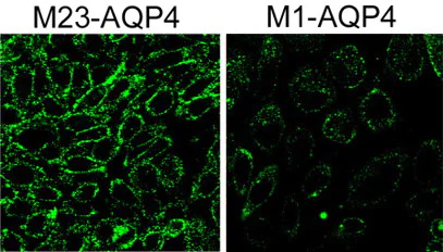 Immunocytochemistry - FITC Anti-C1q antibody (AB4223)