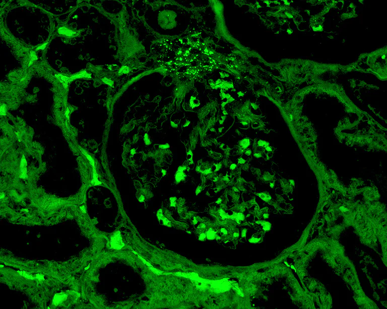 Immunohistochemistry (Formalin/PFA-fixed paraffin-embedded sections) - FITC Anti-C4c+C4b antibody (AB4216)