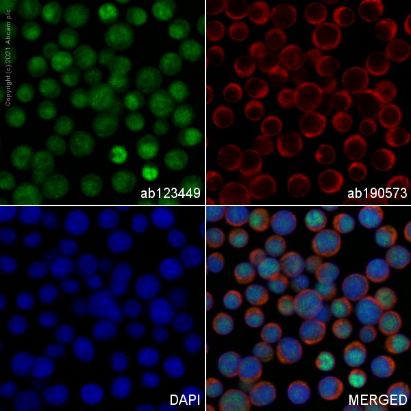 Immunocytochemistry/ Immunofluorescence - FITC Anti-Ctip2 antibody [25B6] (AB123449), expandable thumbnail