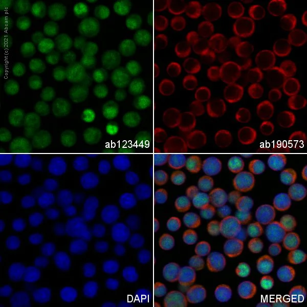 Immunocytochemistry/ Immunofluorescence - FITC Anti-Ctip2 antibody [25B6] (AB123449)