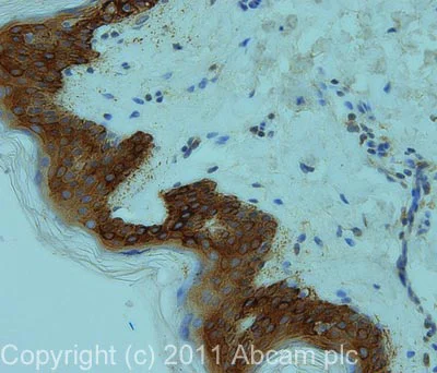 Immunohistochemistry (Formalin/PFA-fixed paraffin-embedded sections) - FITC Anti-Cytokeratin 14 antibody [LL002] (AB77684)