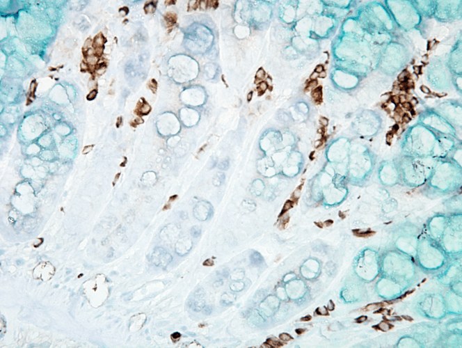 Immunohistochemistry (Formalin/PFA-fixed paraffin-embedded sections) - FITC Anti-DNA/RNA Damage antibody [15A3] (AB183393), expandable thumbnail