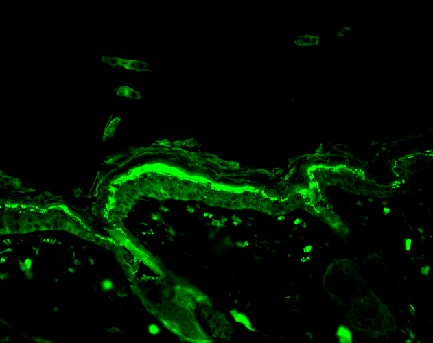 Immunohistochemistry (Formalin/PFA-fixed paraffin-embedded sections) - FITC Anti-DNA/RNA Damage antibody [15A3] (AB183393), expandable thumbnail