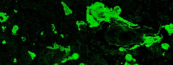 Immunohistochemistry (Formalin/PFA-fixed paraffin-embedded sections) - FITC Anti-Fibrinogen antibody (AB4217)