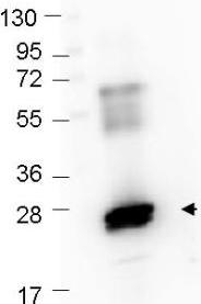 Western blot - FITC Anti-GST antibody (AB106228), expandable thumbnail