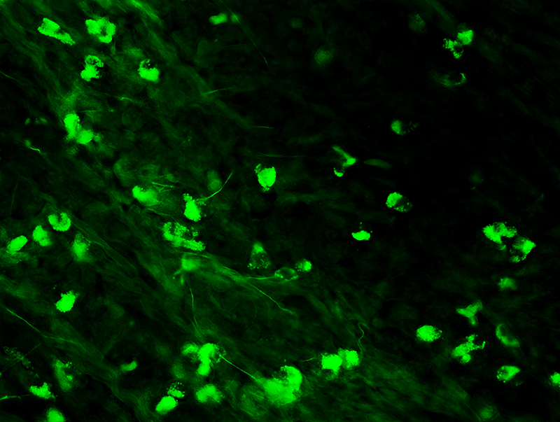 Immunohistochemistry (Formalin/PFA-fixed paraffin-embedded sections) - FITC Anti-Human IgA antibody (AB4219)