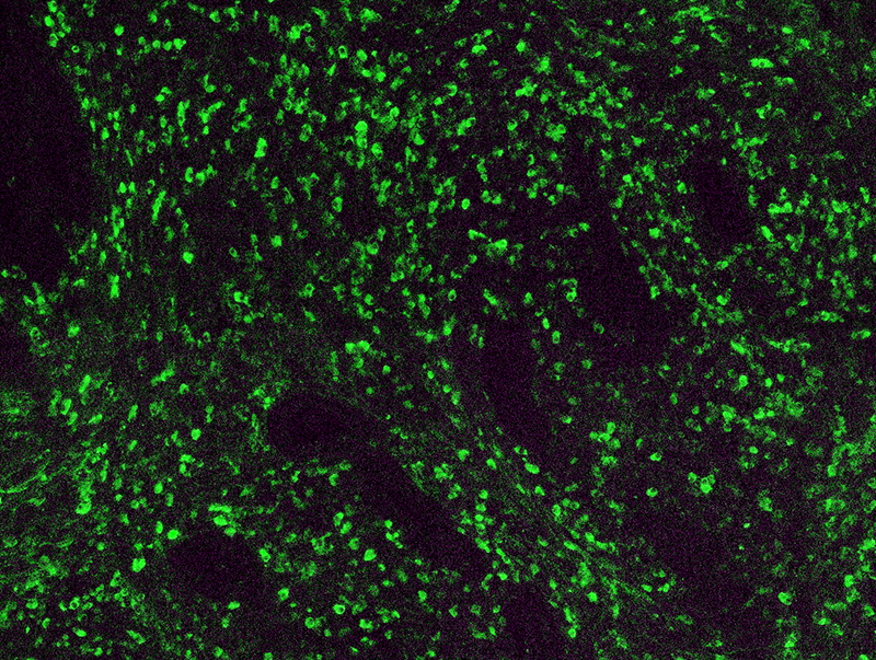 Immunohistochemistry (Formalin/PFA-fixed paraffin-embedded sections) - FITC Anti-Kappa light chain antibody (AB4208), expandable thumbnail