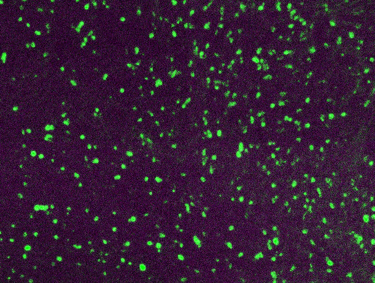 Immunohistochemistry (Formalin/PFA-fixed paraffin-embedded sections) - FITC Anti-Lambda Light chain antibody (AB4211)