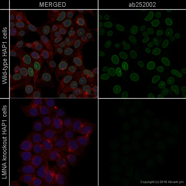 Immunocytochemistry/ Immunofluorescence - FITC Anti-Lamin A + Lamin C antibody [WL4G10] (AB252002)