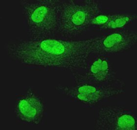 Immunocytochemistry/ Immunofluorescence - FITC Anti-Methylated Lysine antibody (AB53527)