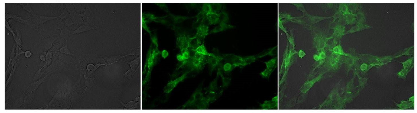 Immunocytochemistry/ Immunofluorescence - FITC Anti-p75 NGF Receptor antibody [8J2] (AB245132), expandable thumbnail