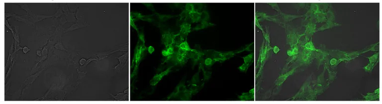 Immunocytochemistry/ Immunofluorescence - FITC Anti-p75 NGF Receptor antibody [8J2] (AB245132)