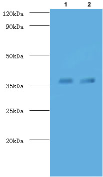 Western blot - FITC Anti-TB Ag85A antibody (AB193480)