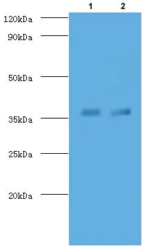Western blot - FITC Anti-TB Ag85A antibody (AB193480)